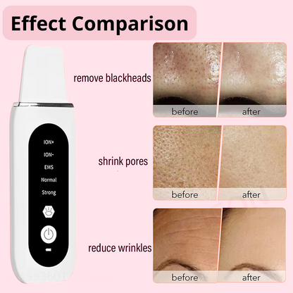 Ultrasonic Skin Scrubber Peeling Blackhead Remover+GIFT HUMIDIFIER